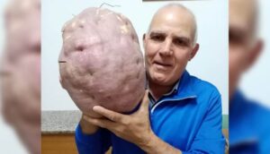 patata-7kg